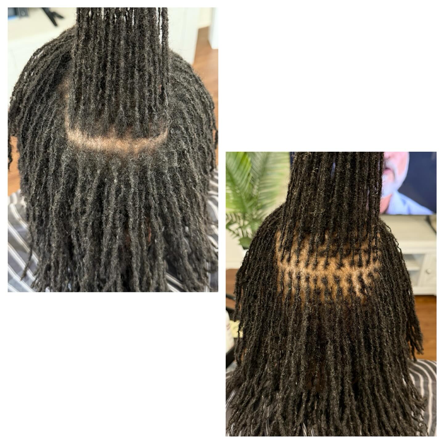 Close-up of freshly twisted dreadlocks with neat parting on a person's scalp.
